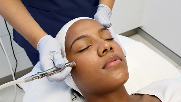 Classic Microdermabrasion - Special Offer Featured Image