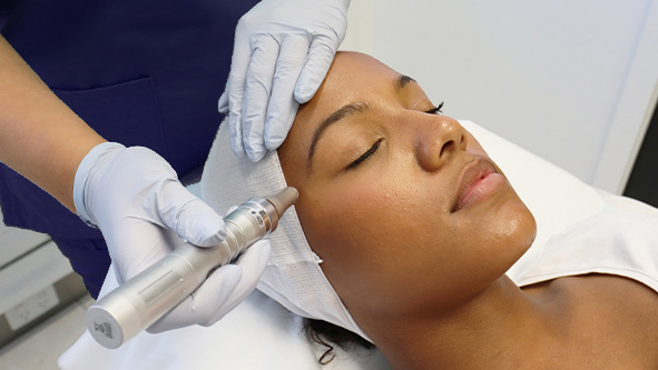 Microneedling Featured Image