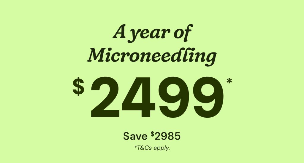 Year of Microneedling Featured Image