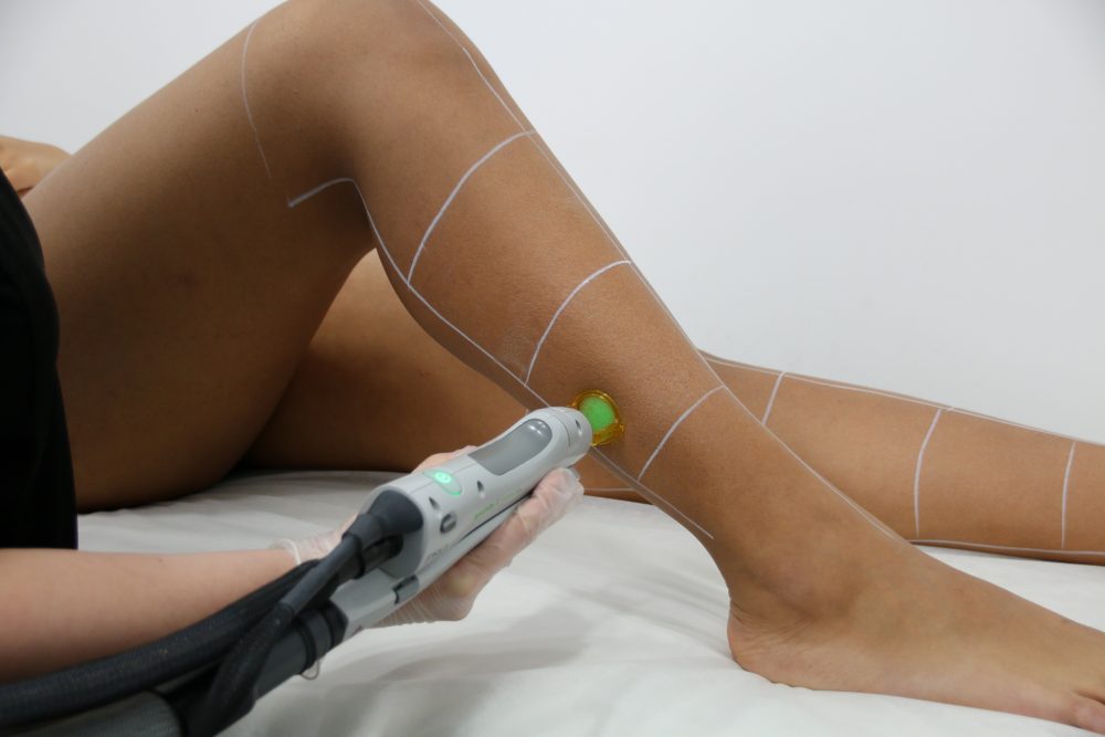 Legs Laser