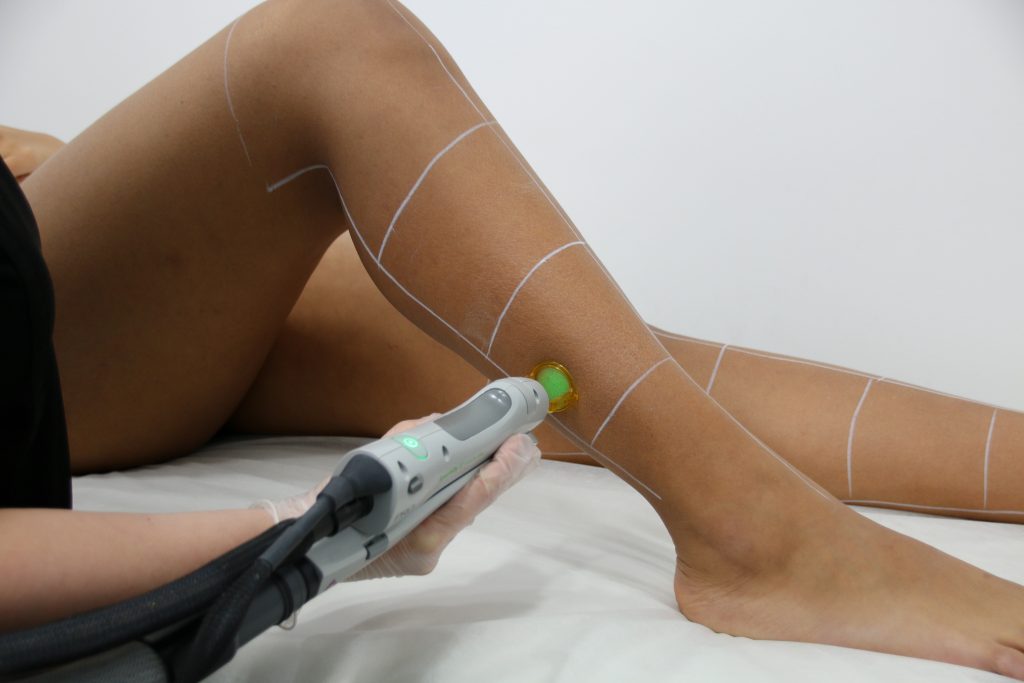 Full Legs, Brazilian (ex Rear) + Underarms